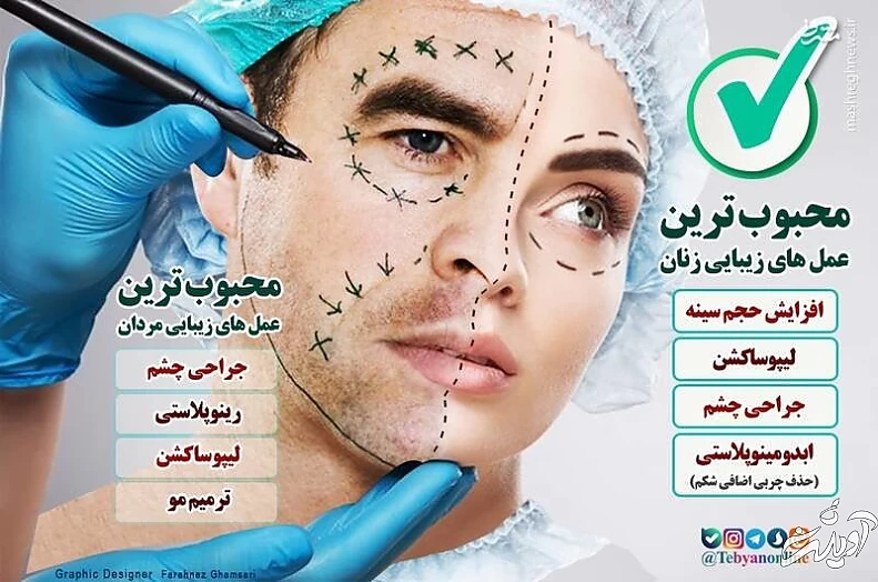رضایت همسر برای عمل جراحی زیبایی و غیرزیبایی مهم است؟/قانون چه میگوید؟